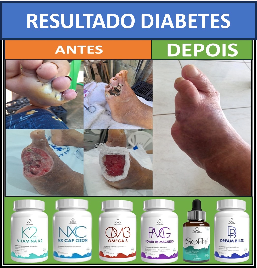 Antes e depois cliente 2